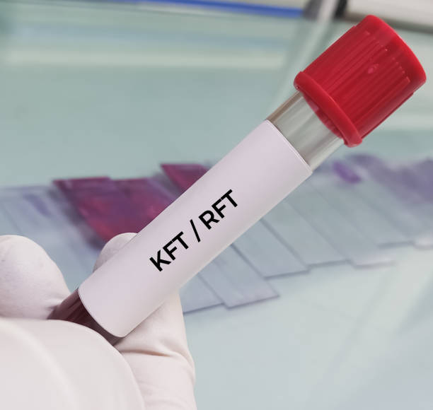 Kidney Function Test (KFT)